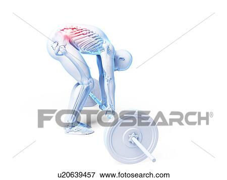 Weight lifting, incorrect posture View Large Illustration Stock Illustration - Weight lifting, incorrect posture. Fotosearch