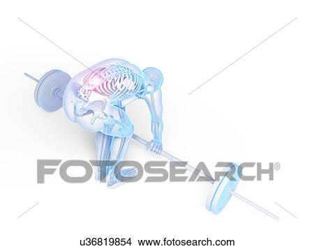 Weight lifting, incorrect posture View Large Illustration Stock Illustration - Weight lifting, incorrect posture. Fotosearch