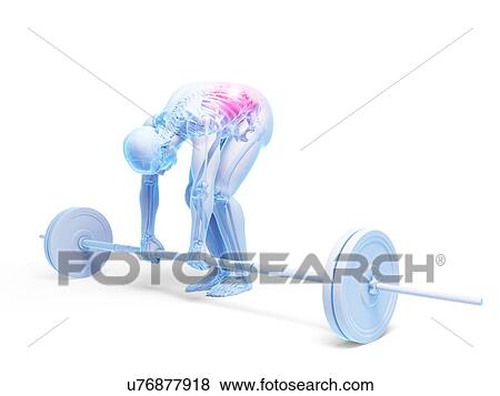 Weight lifting, incorrect posture View Large Illustration Stock Illustration - Weight lifting, incorrect posture. Fotosearch
