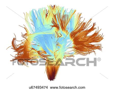 White matter fibres of the human brain View Large Photo Image Picture - White matter fibres of the human brain. Fotosearch