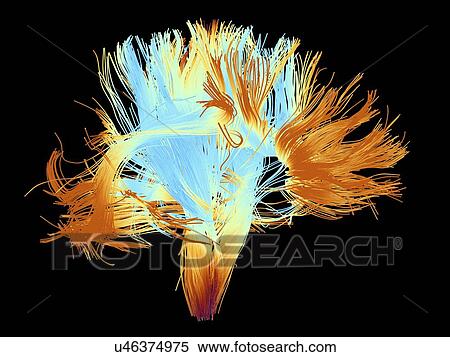 White matter fibres of the human brain View Large Photo Image Stock Photography - White matter fibres of the human brain. Fotosearch