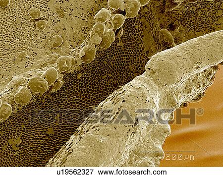 Stock Photo - Antennal sulcus of Ambush bug SEM. Fotosearch