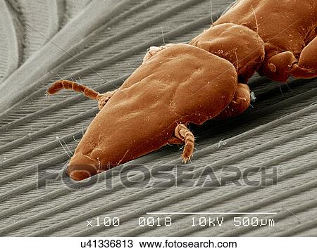 Stock Image - Duck louse, Phthiraptera, attached to feather SEM. Fotosearch