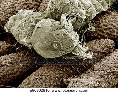 Eggs of Aedes Albopictus mosquito hatching SEM View Large Photo Image Stock Image - Eggs of Aedes Albopictus mosquito hatching SEM. Fotosearch