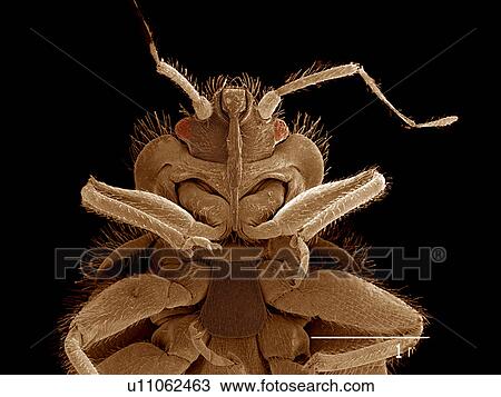 Stock Image - Head of Bat bug, Cimex sp., Cimicidae SEM. Fotosearch