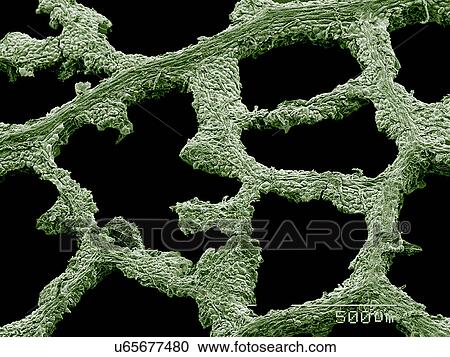Stock Image - Leaf damaged by caterpillar feeding SEM. Fotosearch