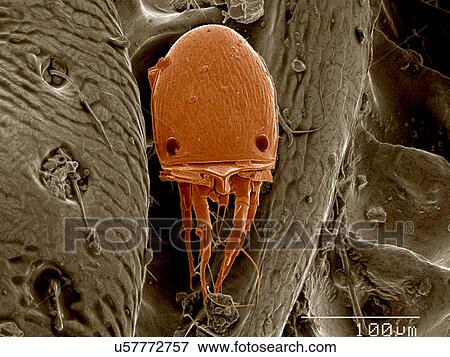 Mite on surface of beetle SEM View Large Photo Image Stock Photo - Mite on surface of beetle SEM. Fotosearch