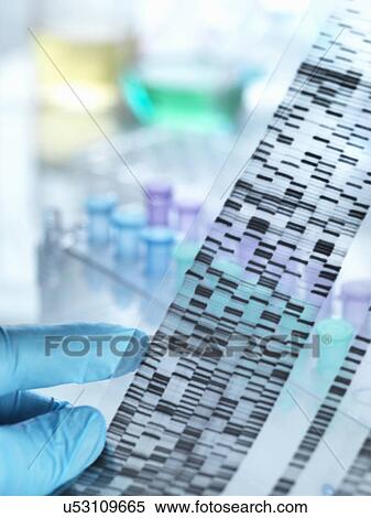 Stock Photography - Scientist holding DNA gel in front of samples for testing in laboratory. Fotosearch
