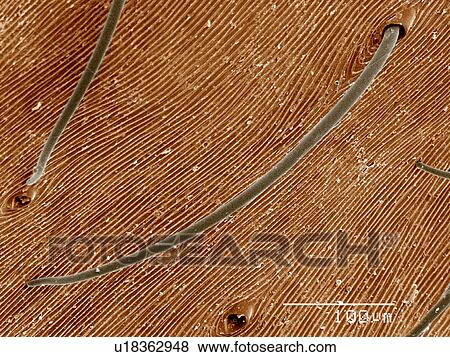 Stock Photo - Setae on back of Orb Weaver spider, Araneus sp SEM. Fotosearch