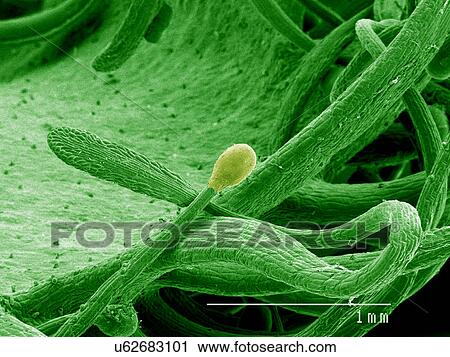 Stock Image - Sticky hair on Sundew leaf, Droscera sp SEM. Fotosearch