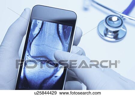 Technology use in healthcare. Doctors hands using smartphone displaying an Xray CT scan of knee View Large Photo Image Stock Photo - Technology use in healthcare. Doctors hands using smartphone displaying an Xray CT scan of knee. Fotosearch