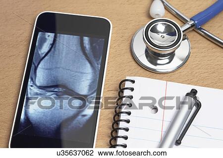 Technology use in healthcare. Smartphone displays an X-ray CT scan of a knee, acoustic stethoscope, notepad, and pen on doctors office desk View Large Photo Image Stock Image - Technology use in healthcare. Smartphone displays an X-ray CT scan of a knee, acoustic stethoscope, notepad, and pen on doctors office desk. Fotosearch