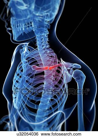 Stock Illustration - Broken collar bone, illustration. Fotosearch