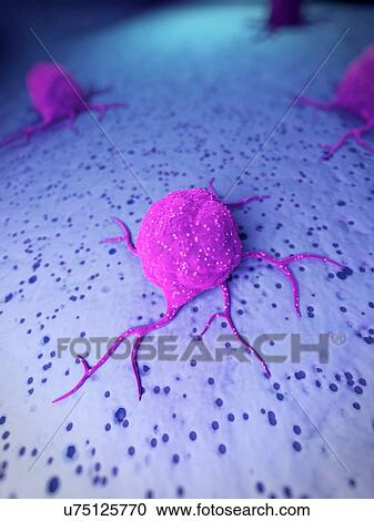 Clipart - Cancer cells, illustration. Fotosearch