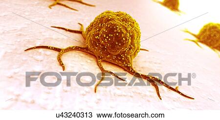 Cancer cells, illustration View Large Illustration Drawing - Cancer cells, illustration. Fotosearch