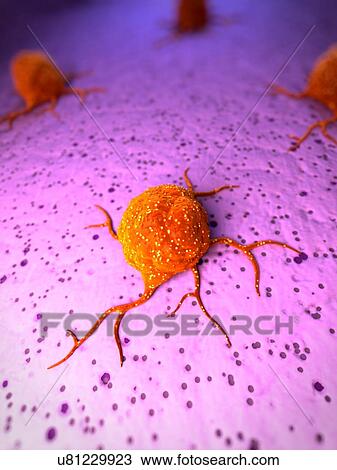 Cancer cells, illustration View Large Illustration Drawing - Cancer cells, illustration. Fotosearch