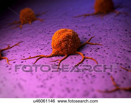 Stock Illustration - Cancer cells, illustration. Fotosearch