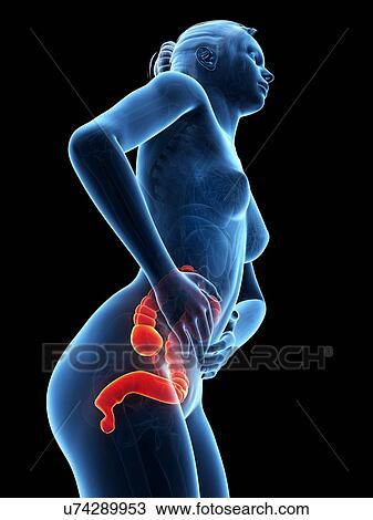Drawing - Female digestive pain, illustration. Fotosearch