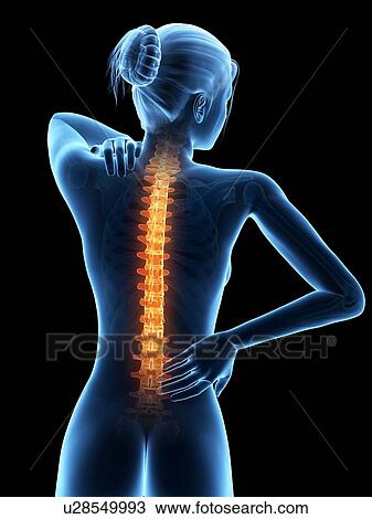 Human back pain, illustration View Large Illustration Drawing - Human back pain, illustration. Fotosearch