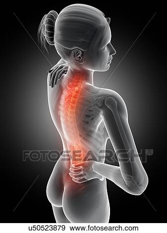 Stock Illustration - Human back pain, illustration. Fotosearch