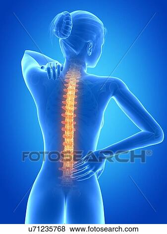 Stock Illustration - Human back pain, illustration. Fotosearch
