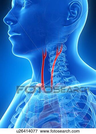 Stock Illustration - Human carotid artery, illustration. Fotosearch