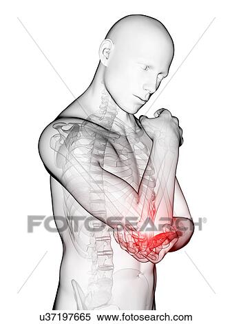 Stock Illustration - Human elbow pain, illustration. Fotosearch