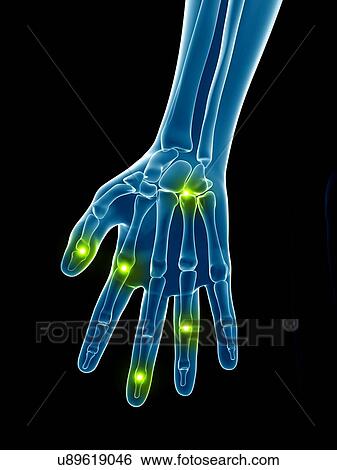 Human finger joints, illustration View Large Illustration Stock Illustration - Human finger joints, illustration. Fotosearch