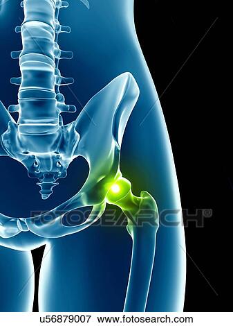 Human hip joint, illustration View Large Illustration Stock Illustration - Human hip joint, illustration. Fotosearch