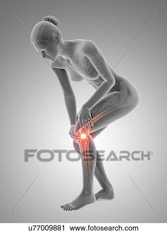 Human knee pain, illustration View Large Illustration Clip Art - Human knee pain, illustration. Fotosearch