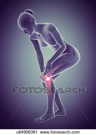 Human knee pain, illustration View Large Illustration Clip Art - Human knee pain, illustration. Fotosearch