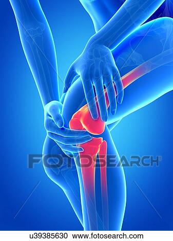 Clipart - Human knee pain, illustration. Fotosearch