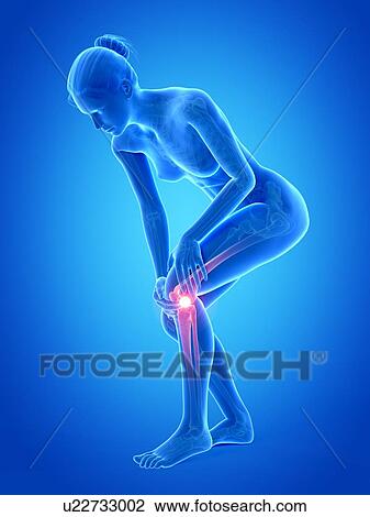 Human knee pain, illustration View Large Illustration Drawing - Human knee pain, illustration. Fotosearch
