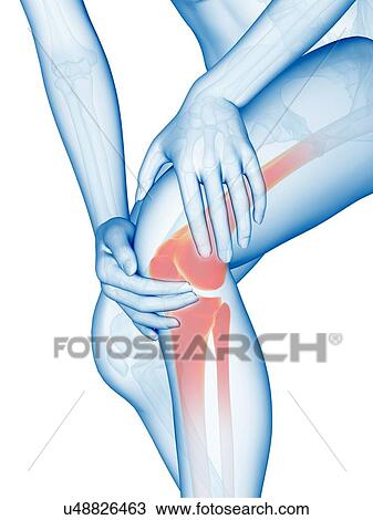 Human knee pain, illustration View Large Illustration Drawing - Human knee pain, illustration. Fotosearch