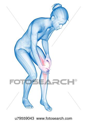 Human knee pain, illustration View Large Illustration Drawing - Human knee pain, illustration. Fotosearch