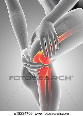 Human knee pain, illustration View Large Illustration Stock Illustration - Human knee pain, illustration. Fotosearch