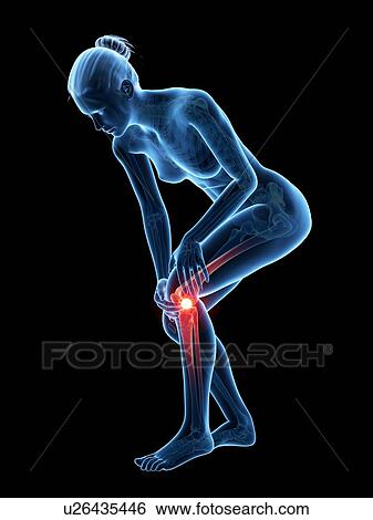 Human knee pain, illustration View Large Illustration Stock Illustration - Human knee pain, illustration. Fotosearch