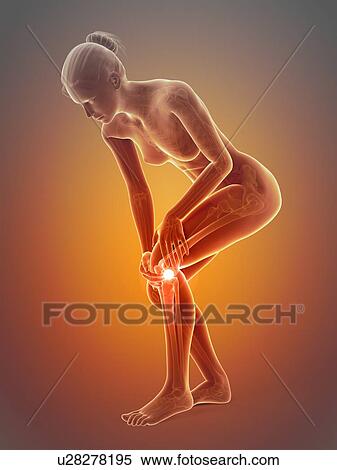 Human knee pain, illustration View Large Illustration Stock Illustration - Human knee pain, illustration. Fotosearch
