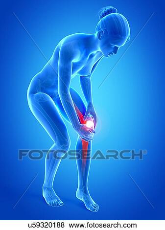 Stock Illustration - Human knee pain, illustration. Fotosearch