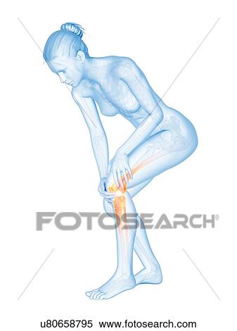 Human knee pain, illustration View Large Illustration Stock Illustration - Human knee pain, illustration. Fotosearch
