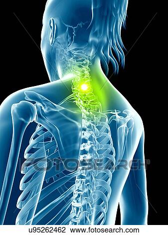 Drawing - Human neck bones, illustration. Fotosearch