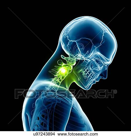 Human neck bones, illustration View Large Illustration Stock Illustration - Human neck bones, illustration. Fotosearch