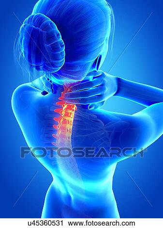 Human neck pain, illustration View Large Illustration Clip Art - Human neck pain, illustration. Fotosearch