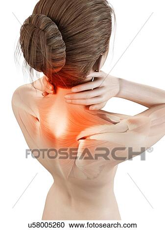 Human neck pain, illustration View Large Illustration Clipart - Human neck pain, illustration. Fotosearch