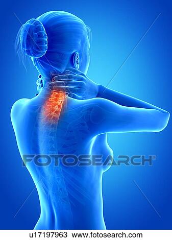 Human neck pain, illustration View Large Illustration Drawing - Human neck pain, illustration. Fotosearch