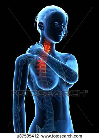 Human neck pain, illustration View Large Illustration Drawing - Human neck pain, illustration. Fotosearch