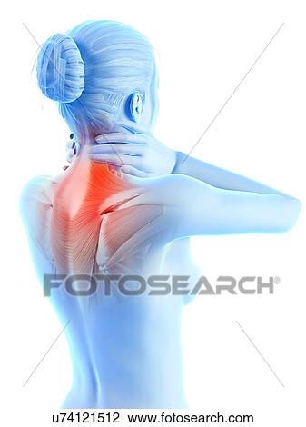 Human neck pain, illustration View Large Illustration Drawing - Human neck pain, illustration. Fotosearch