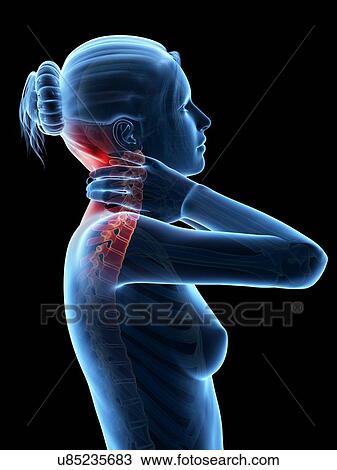 Human neck pain, illustration View Large Illustration Drawing - Human neck pain, illustration. Fotosearch