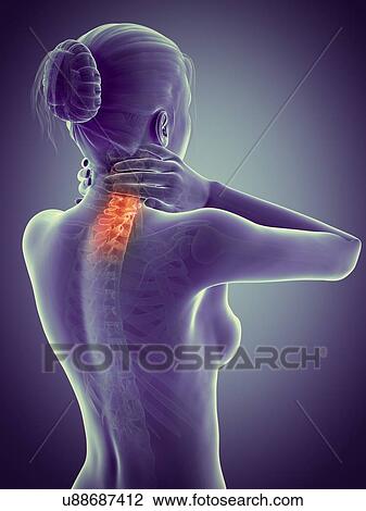 Human neck pain, illustration View Large Illustration Drawing - Human neck pain, illustration. Fotosearch