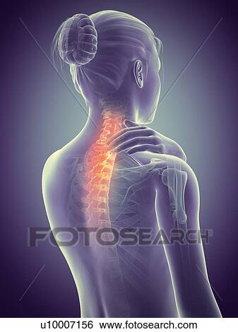Human neck pain, illustration View Large Illustration Stock Illustration - Human neck pain, illustration. Fotosearch